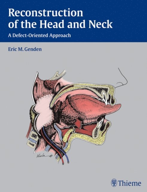 Eric M. Genden - Reconstruction of the Head and Neck, E-bok