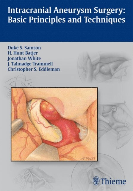 Christopher S. Eddleman, Talmadge Trammell, Jonathan White, H. Hunt Batjer, Duke Samson - Intracranial Aneurysm Surgery, E-bok