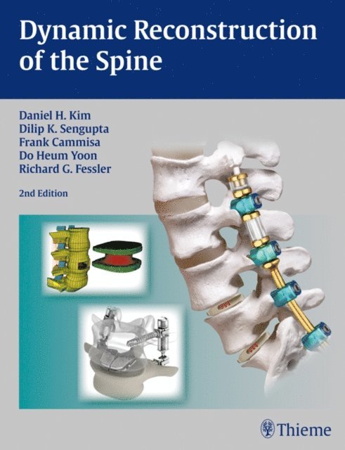 Richard Glenn Fessler, Do Heum Yoon, Frank P Cammisa, Dilip K Sengupta, Daniel H. Kim - Dynamic Reconstruction of the Spine, E-bok