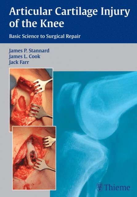 Jack Farr, James L. Cook, James P. Stannard - Articular Cartilage Injury of the Knee: Basic Science to Surgical Repair, E-bok