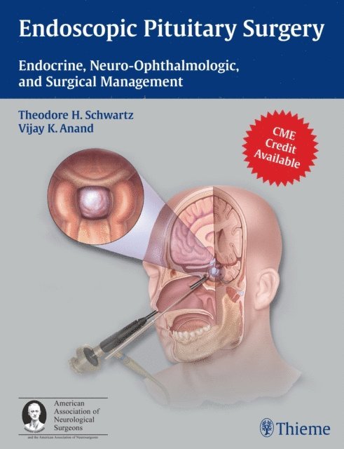 Vijay K. Anand, Theodore H. Schwartz - Endoscopic Pituitary Surgery, E-bok