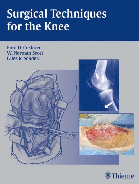 Giles R. Scuderi, W. Norman Scott, Fred D. Cushner - Surgical Techniques for the Knee, E-bok
