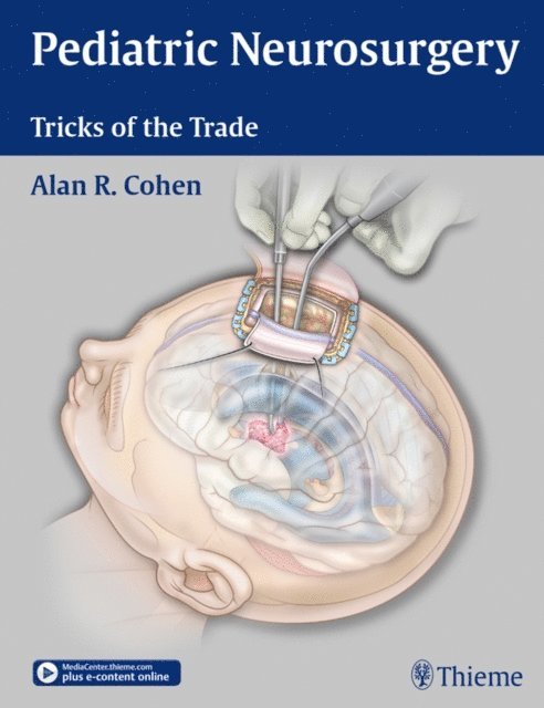 Alan R. Cohen - Pediatric Neurosurgery: Tricks of the Trade, E-bok