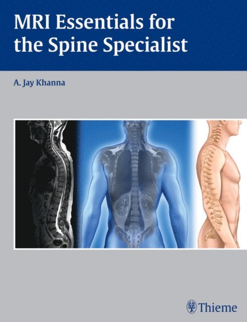 A. Jay Khanna - MRI Essentials for the Spine Specialist, E-bok