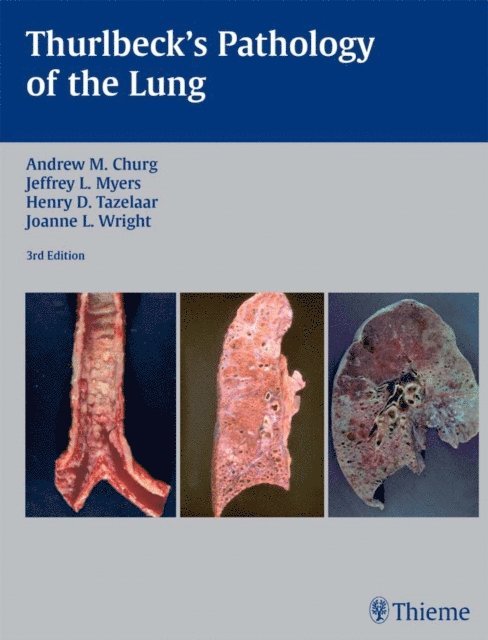 Joanne L. Wright, Henry D. Tazelaar, Jeffrey L. Myers, Andrew M. Churg - Thurlbeck's Pathology of the Lung, E-bok