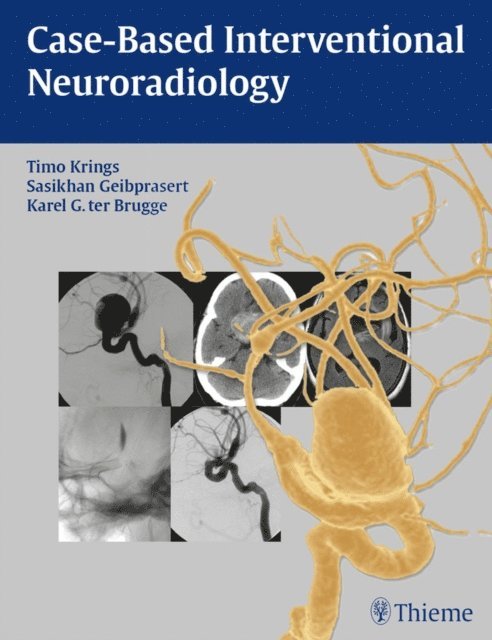 Karel ter Brugge, Sasikhan Geibprasert, Timo Krings - Case-Based Interventional Neuroradiology, E-bok