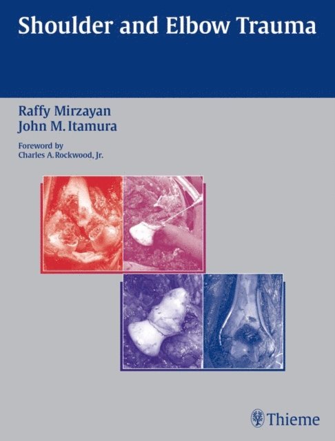 John M. Itamura, Raffy Mirzayan - Shoulder and Elbow Trauma, E-bok