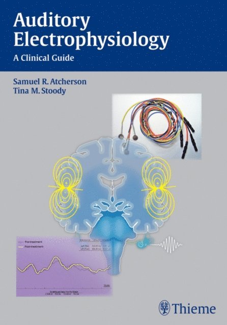 Tina M. Stoody, Samuel R. Atcherson - Auditory Electrophysiology, E-bok. Tillgänglighet: Lägg i varukorg