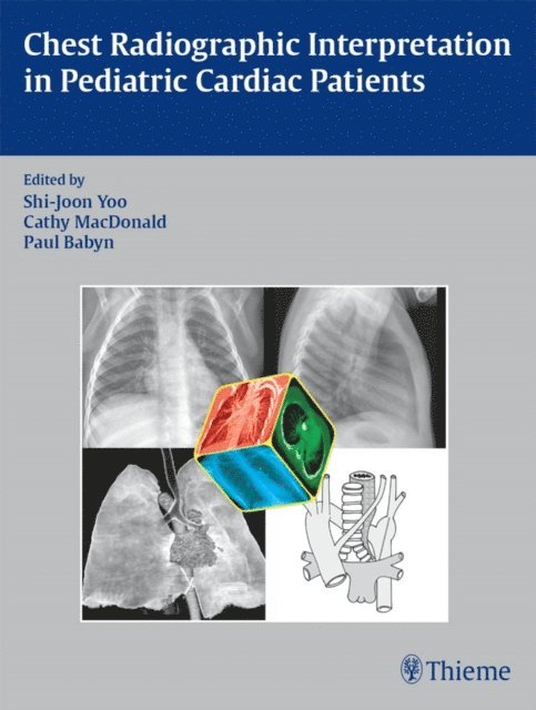 Paul Babyn, Cathy MacDonald, Shi-Joon Yoo - Chest Radiographic Interpretation in Pediatric Cardiac Patients, E-bok