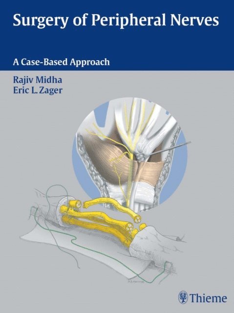 Eric L. Zager, Rajiv Midha - Surgery of Peripheral Nerves, E-bok