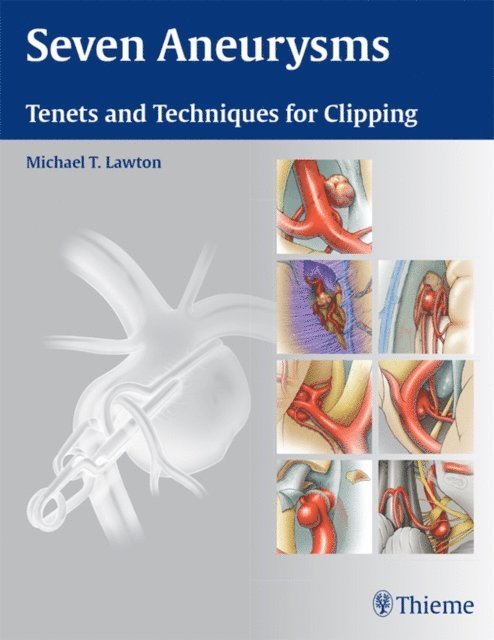 Michael T. Lawton - Seven Aneurysms, E-bok