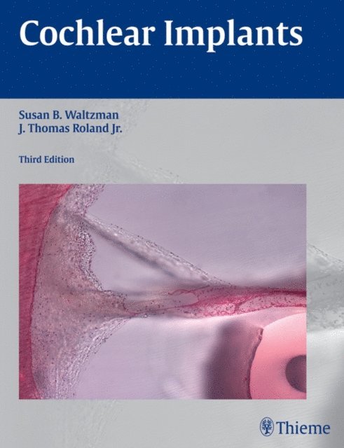 J. Thomas Roland, Susan B. Waltzman - Cochlear Implants, E-bok