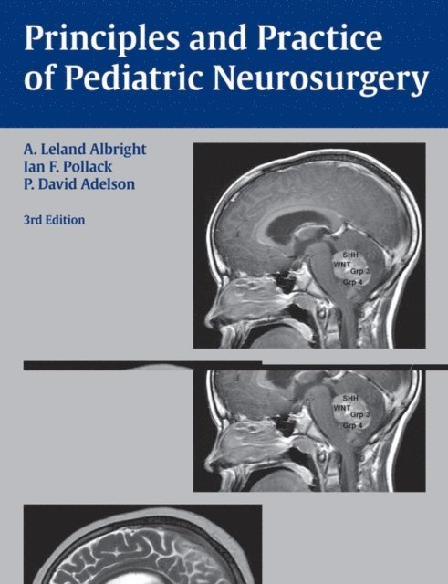 P. David Adelson, Ian F. Pollack, A. Leland Albright - Principles and Practice of Pediatric Neurosurgery, E-bok