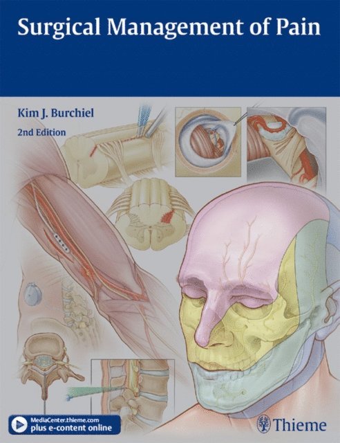 Kim J. Burchiel - Surgical Management of Pain, E-bok