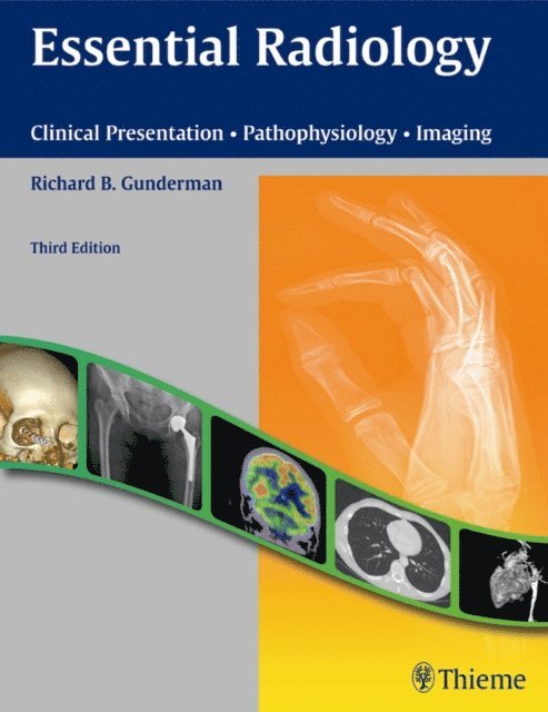 Richard B. Gunderman - Essential Radiology, E-bok