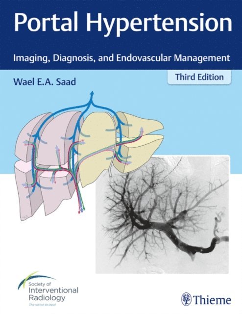 Wael E.A. Saad - Portal Hypertension, E-bok. Tillgänglighet: Lägg i varukorg