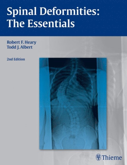 Todd J. Albert, Robert F. Heary - Spinal Deformities, E-bok