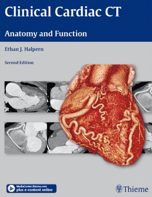 Ethan J. Halpern - Clinical Cardiac CT, E-bok. Tillgänglighet: Lägg i varukorg