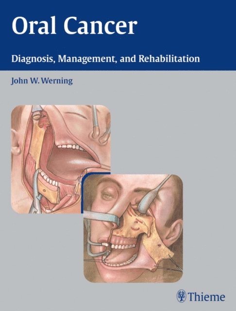 John W. Werning - Oral Cancer, E-bok