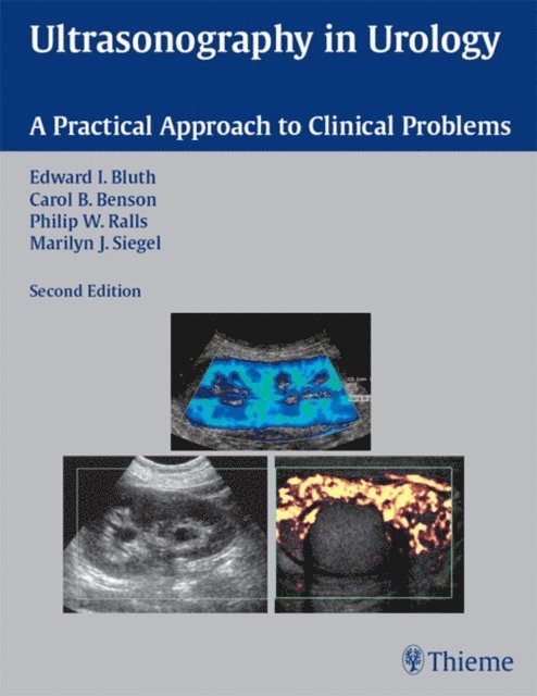 Carol B. Benson, Edward I. Bluth - Ultrasonography in Urology, E-bok