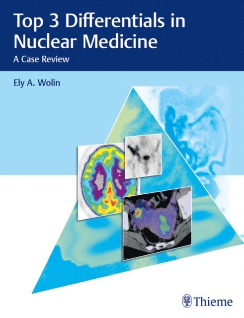 Ely A. Wolin - Top 3 Differentials in Nuclear Medicine, E-bok