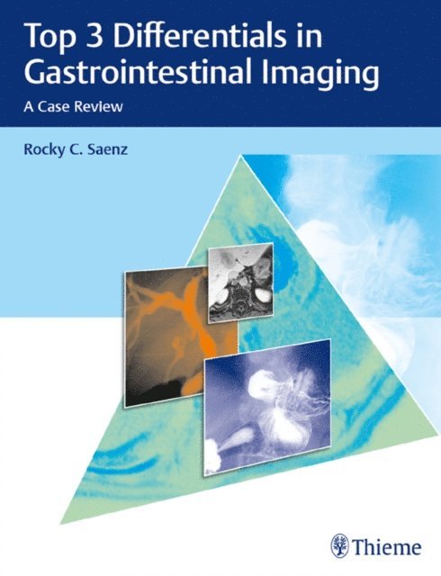 Rocky C. Saenz - Top 3 Differentials in Gastrointestinal Imaging, E-bok