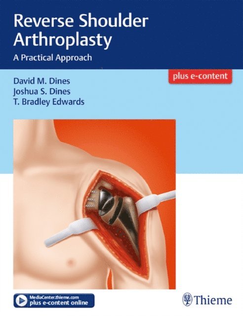 T Bradley Edwards, Joshua Dines, David M. Dines - Reverse Shoulder Arthroplasty, E-bok
