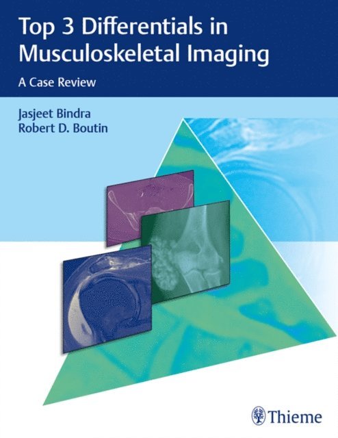 Robert D. Boutin, Jasjeet Bindra - Top 3 Differentials in Musculoskeletal Imaging, E-bok