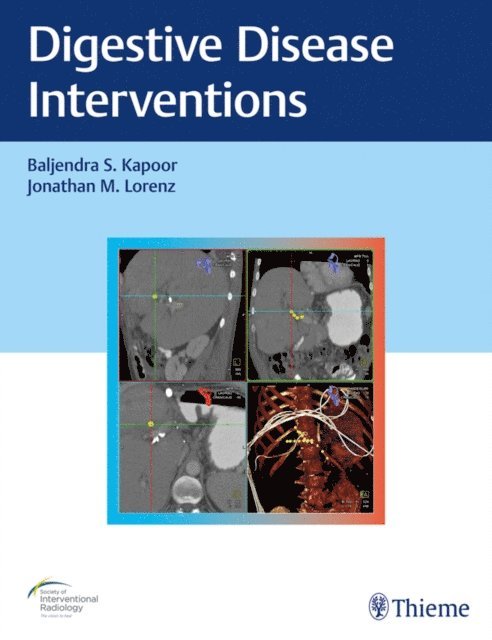 Jonathan M. Lorenz, Baljendra Kapoor - Digestive Disease Interventions, E-bok