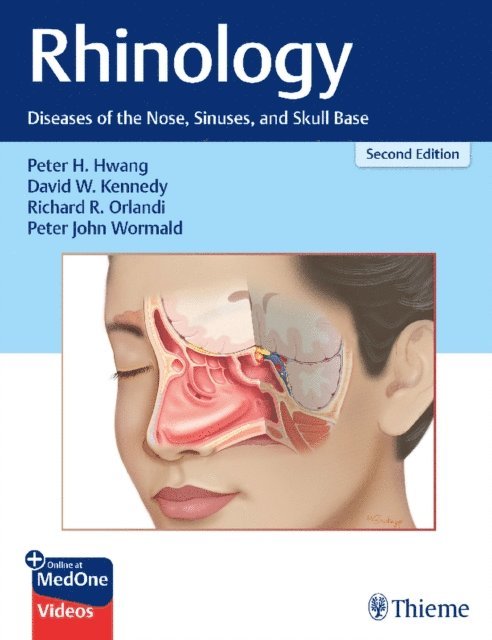Peter John Wormald, Richard R Orlandi, David W. Kennedy, Peter H. Hwang - Rhinology, E-bok
