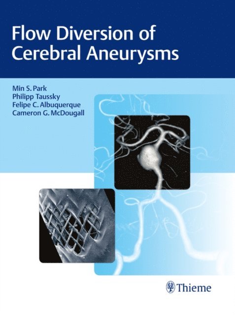 Cameron G. McDougall, Felipe C. Albuquerque, Phil Taussky, Min S. Park - Flow Diversion of Cerebral Aneurysms, E-bok