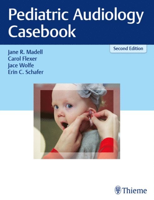 Erin C. Schafer, Jace Wolfe, Carol Flexer, Jane R. Madell - Pediatric Audiology Casebook, E-bok