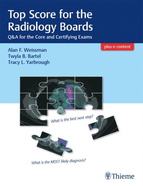 Alan Weissman - Top Score for the Radiology Boards, E-bok