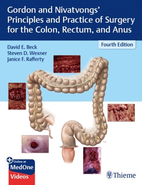 Janice F. Rafferty, Steven D. Wexner, David E. Beck - Gordon and Nivatvongs' Principles and Practice of Surgery for the Colon, Rectum, and Anus, E-bok