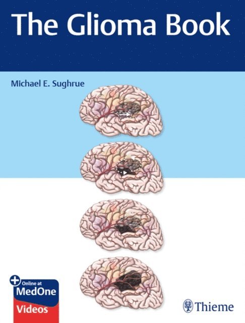 Michael E. Sughrue - Glioma Book, E-bok