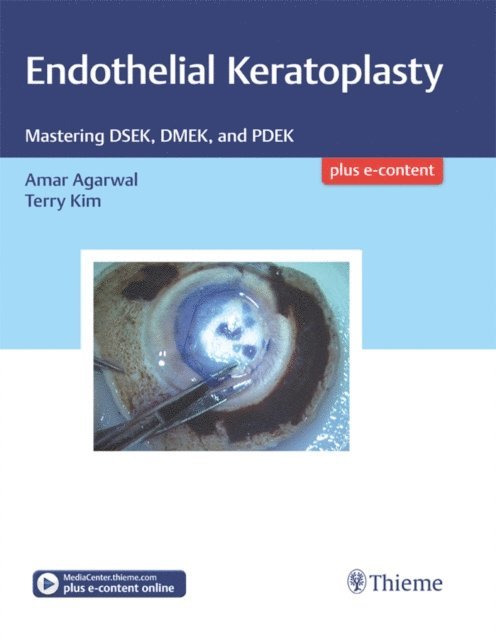 Terry Kim, Amar Agarwal - Endothelial Keratoplasty, E-bok