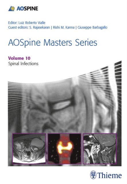 Giuseppe MV Barbagallo, Rishi Mugesh Kanna, Shanmuganathan Rajasekaran - AOSpine Masters Series, Volume 10: Spinal Infections, E-bok
