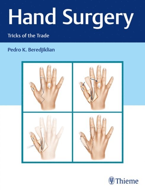 Pedro Beredjiklian - Hand Surgery, E-bok