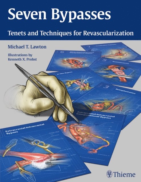 Michael T. Lawton - Seven Bypasses, E-bok