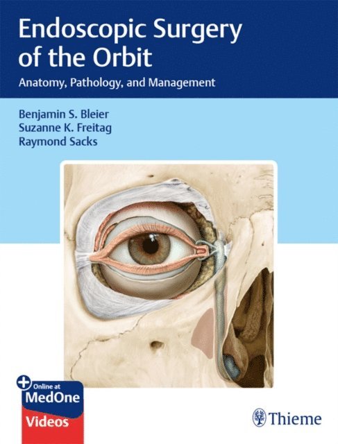 Raymond Sacks, Suzanne K. Freitag, Benjamin S. Bleier - Endoscopic Surgery of the Orbit, E-bok
