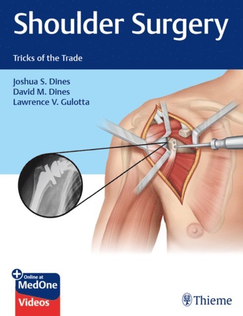Lawrence V. Gulotta, David M. Dines, Joshua Dines - Shoulder Surgery, E-bok