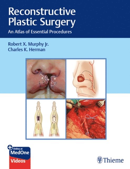 Charles Herman, Robert Murphy - Reconstructive Plastic Surgery, E-bok