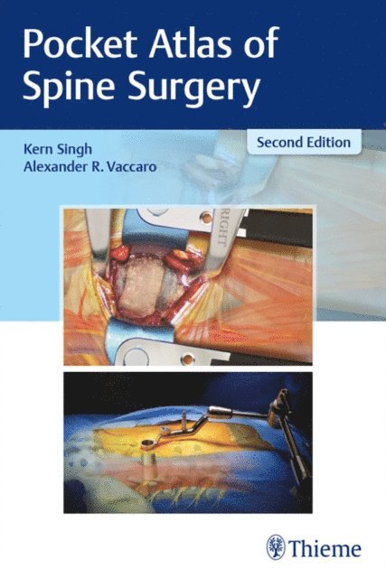 Alexander R. Vaccaro, Kern Singh - Pocket Atlas of Spine Surgery, E-bok