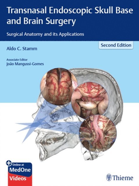 Aldo C. Stamm - Transnasal Endoscopic Skull Base and Brain Surgery, E-bok