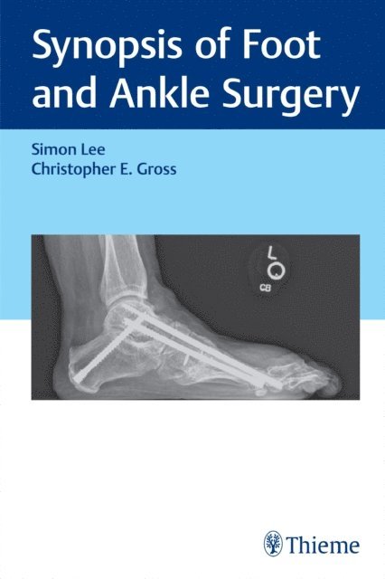 Christopher Gross, Simon Lee - Synopsis of Foot and Ankle Surgery, E-bok