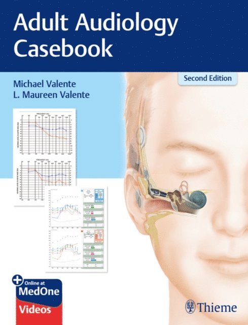 L. Maureen Valente, Michael Valente - Adult Audiology Casebook, E-bok
