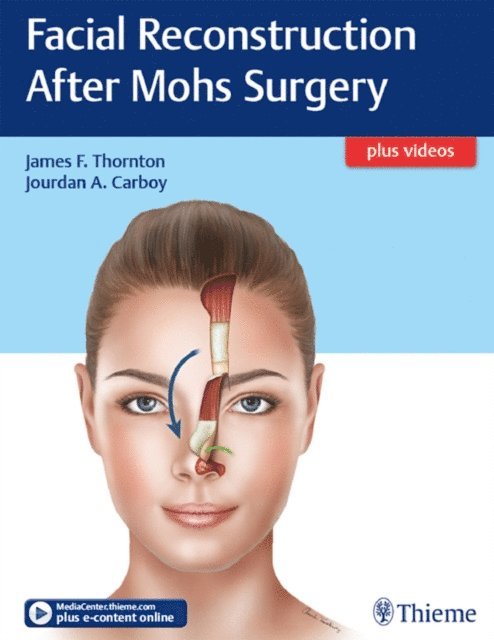 Jourdan A. Carboy, James Thornton - Facial Reconstruction After Mohs Surgery, E-bok