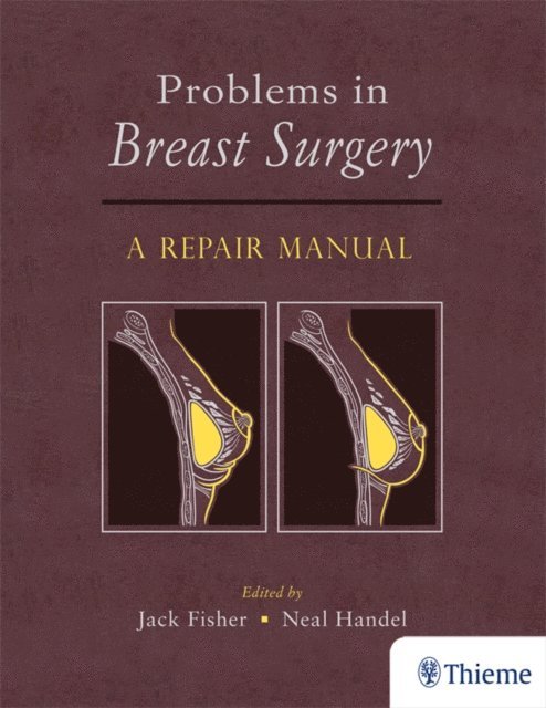 Neal Handel, Jack Fisher - Problems in Breast Surgery, E-bok