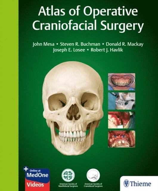 Robert J. Havlik, Joseph E. Losee, Donald R. Mackay, Steven R. Buchman, John Mesa - Atlas of Operative Craniofacial Surgery, E-bok