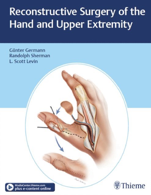 Randolph Sherman, L. Scott Levin, Gunter Germann - Reconstructive Surgery of the Hand and Upper Extremity, E-bok